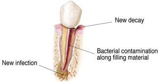 tooth graphic