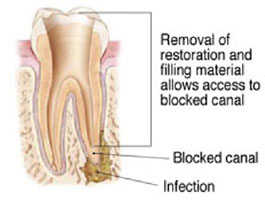 tooth graphic