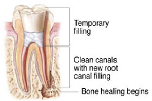 tooth graphic