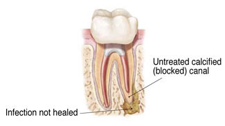 tooth graphic