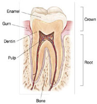 root canal graphic